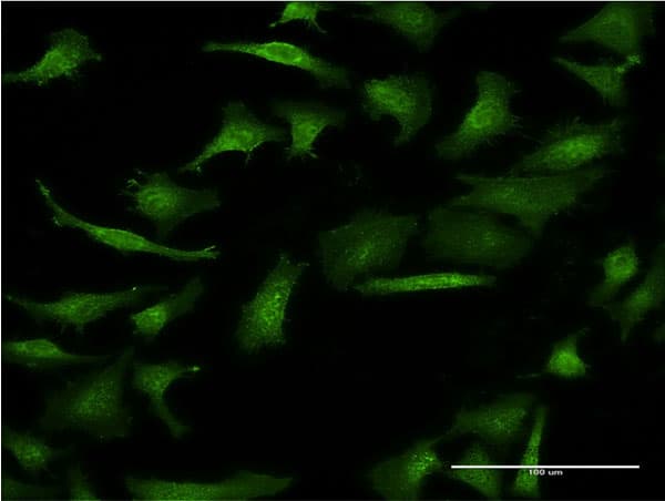 GIF / Intrinsic Factor Antibody (clone 1D9)