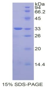 Human AHR Protein (Recombinant His, N-Terminal)