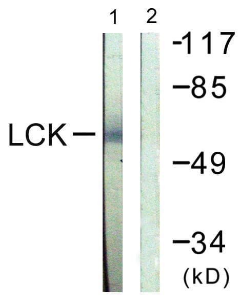 Polyclonal Rabbit anti-Human p56lck / LCK Antibody (p505, IF, WB)