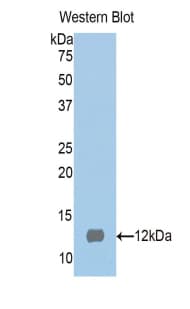 S100A1 / S100-A1 Antibody (aa2-94, Biotin)