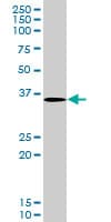 STRADA / LYK5 Antibody (clone 4E4)