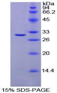 Chicken CA2 / Carbonic Anhydrase II Protein (Recombinant His)
