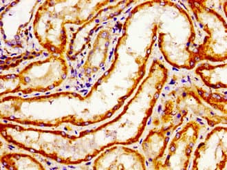ARHGAP1 / CDC42GAP Antibody