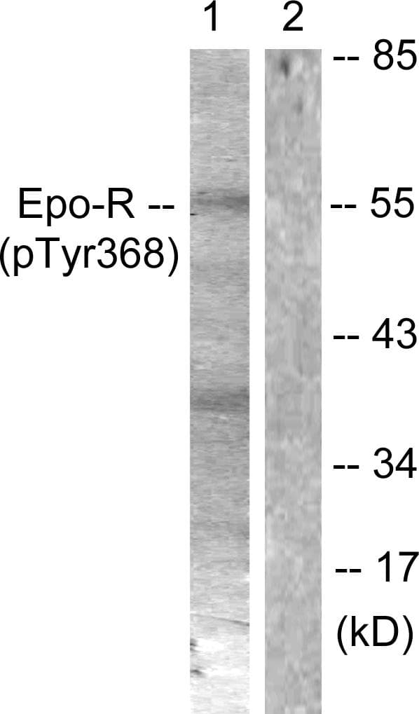 EPOR / EPO Receptor Antibody (phospho-Tyr368)