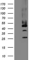 Monoclonal Mouse anti-Human Mannose Phosphate Isomerase Antibody (clone OTI4E7, IHC, WB)