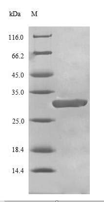 Human BRCA1 Protein (Recombinant 6His, N-terminus)
