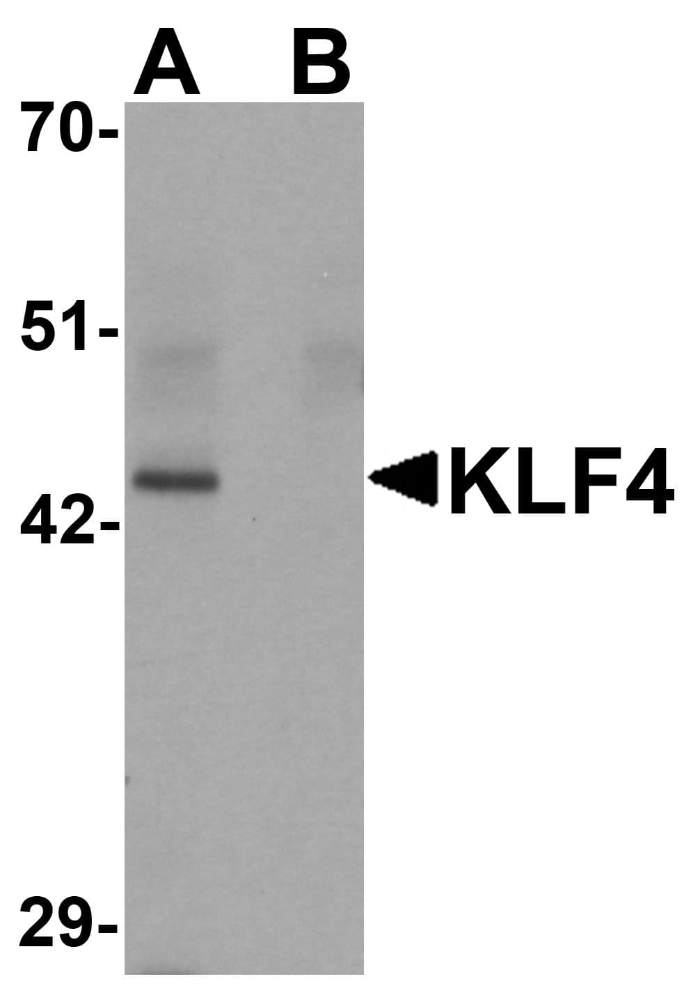 KLF4 Antibody (clone 4E5C3)