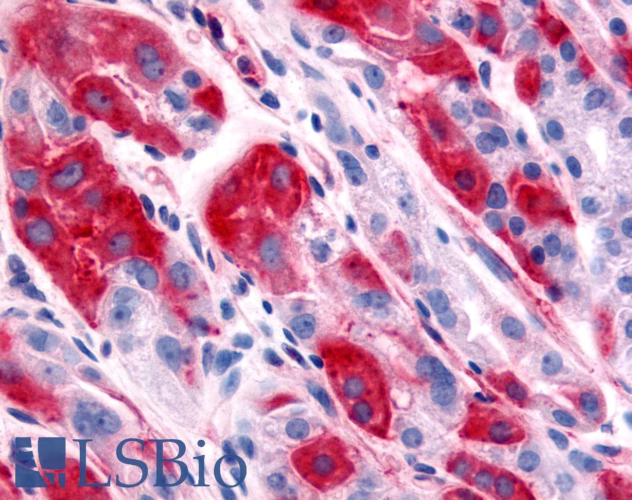 IHC-plus™ DPP2 / DPP7 Antibody (Extracellular Domain)