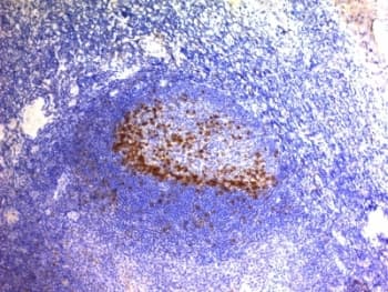 PDCD1 / CD279 / PD-1 Antibody (clone SPM597)