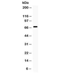 Polyclonal Rabbit anti-Human MMP9 / Gelatinase B Antibody (WB)