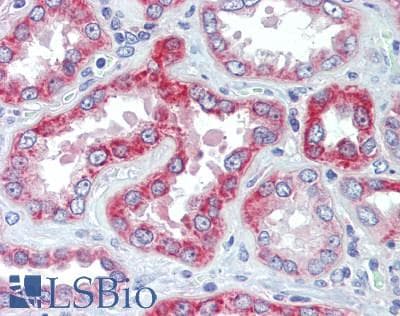 PathPlus™ Polyclonal Rabbit anti-Human GLS / Glutaminase Antibody (IHC)