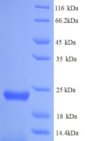 E. coli lolA Protein (Recombinant His)