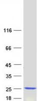 Human CDKN2D / p19 INK4d Protein (Recombinant Myc-DDK (Flag))