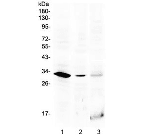 Polyclonal Rabbit anti-Human HOXB1 Antibody (WB)