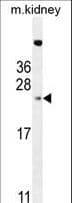 Polyclonal Rabbit anti-Human ADO Antibody (aa206-233, WB)