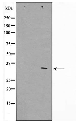 Polyclonal Rabbit anti-Human GFRA4 Antibody (WB)