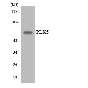 Polyclonal Rabbit anti-Human PLK5 Antibody (aa126-175, WB)