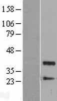 Human PPP1CB Protein (Over-Expression Lysate Myc-DDK (Flag))