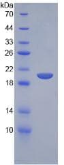 Mouse SLPI / Antileukoproteinase (Recombinant His, N-Terminal)