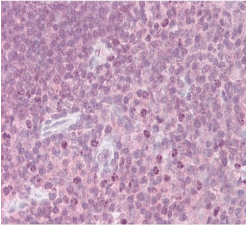 Monoclonal Mouse anti-Human CRLF2 / TSLPR Antibody (clone 8H8, IHC, WB)