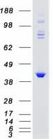 Human GRK5 Protein (Recombinant Myc-DDK (Flag))