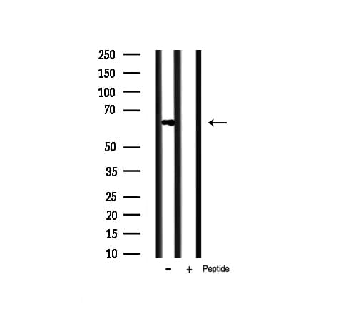 Polyclonal Rabbit anti-Human PAK1 Antibody (IHC, IF, WB)