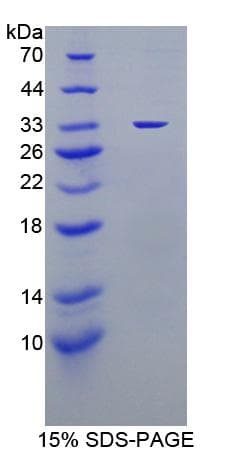 Mouse TP / Thymidine Phosphorylase Protein (Recombinant His-T7)