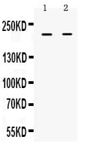 Polyclonal Rabbit anti-Human BRCA1 Antibody (WB)