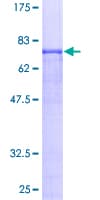 Human APP / Beta Amyloid Precursor Protein (Recombinant GST)