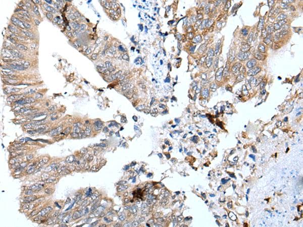 Polyclonal Rabbit anti-Human GKN1 / Gastrokine 1 Antibody (IHC, WB)