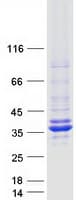 Human ECH1 Protein (Recombinant Myc-DDK (Flag))