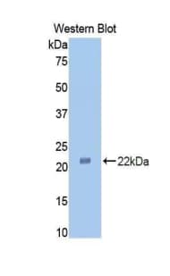 VCAM1 / CD106 Antibody (aa511-682)