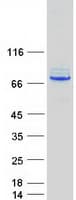 Human CTPS Protein (Recombinant Myc-DDK (Flag))