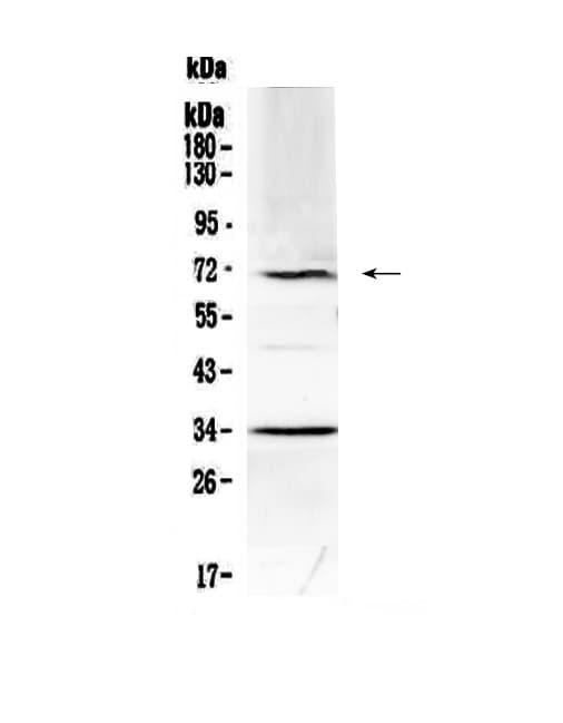 Polyclonal Rabbit anti-Mouse Alpha-Fetoprotein Antibody (WB)