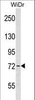 Polyclonal Rabbit anti-Mouse WEE1 Antibody (aa202-230, WB)