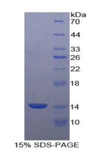 Human CAV1 / Caveolin 1 Protein (Recombinant His)