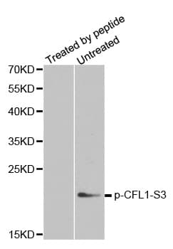 CFL1 / Cofilin Antibody (phospho-Ser3)