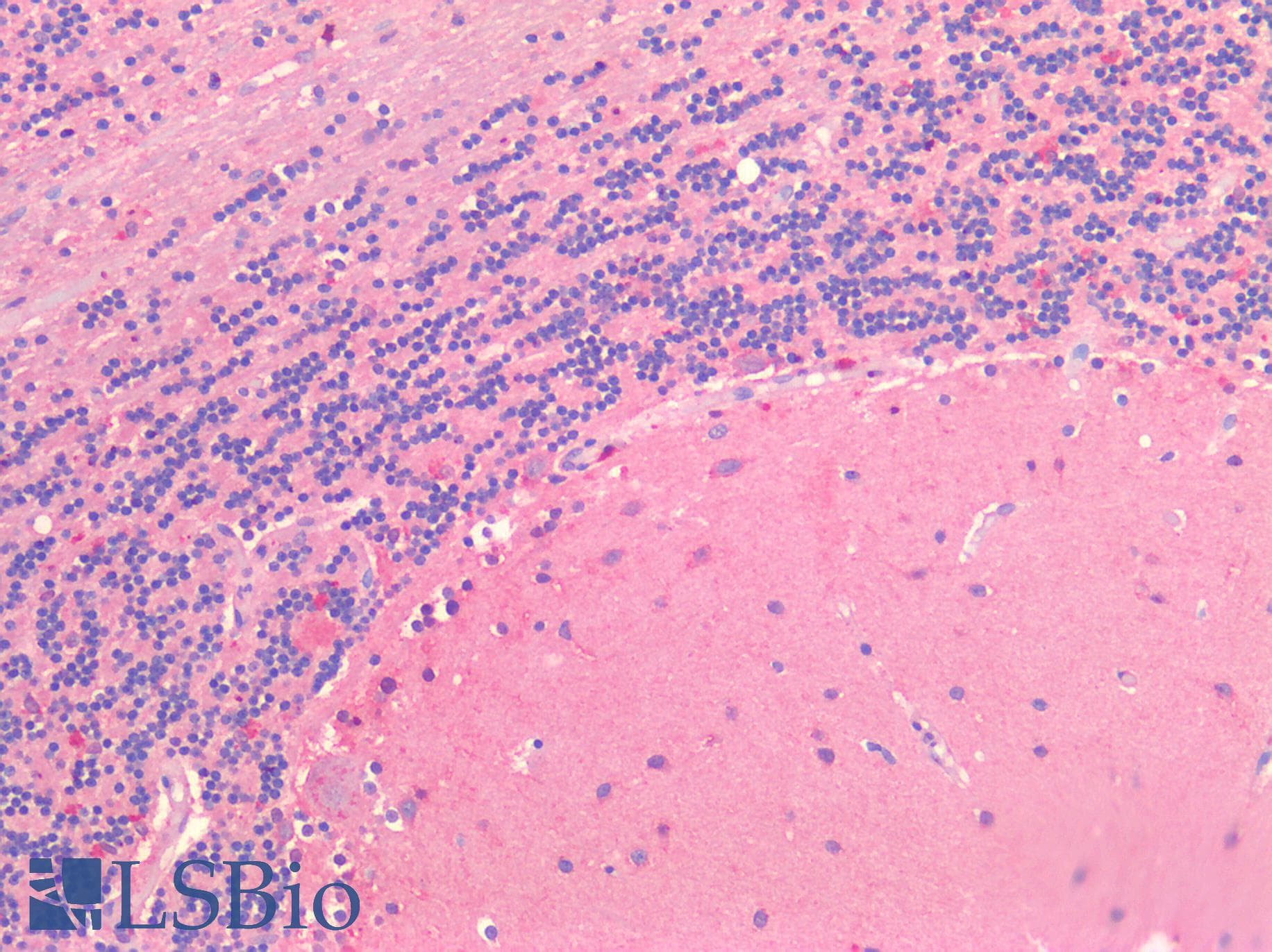 IHC-plus™ CX3CL1 / Fractalkine Antibody