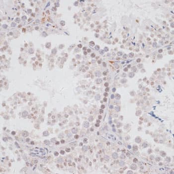 KDM3A / JMJD1A Antibody