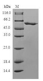 Human SLC4A1 / Band 3 / AE1 Protein (Recombinant 10His, N-terminus + Myc, C-terminus)