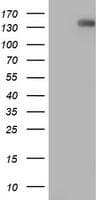 ERBB2 / HER2 Antibody (aa676-1255, clone OTI9G2, Carrier-free)