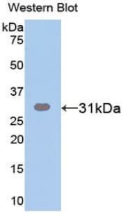 IGF2BP2 Antibody (aa141-384, Biotin)