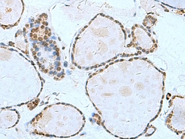 L3MBTL2 Antibody