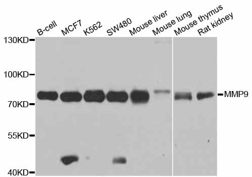 MMP9 / Gelatinase B Antibody