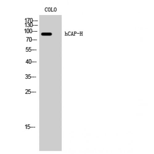 Polyclonal Rabbit anti-Human NCAPH / CAP-H Antibody (410-490 aa, Internal, WB)
