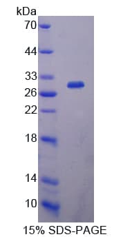 Pig IL2RA / CD25 Protein (Recombinant His-T7)