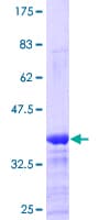 Human VCP Protein (Recombinant GST, N-terminus)