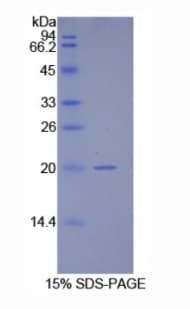 Human HSPE1 / HSP10 / Chaperonin 10 Protein (Recombinant His)