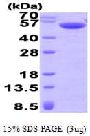 Human CASQ2 / Calsequestrin 2 Protein (Recombinant His)