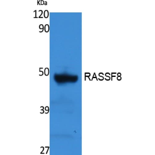 RASSF8 Antibody (60-140 aa, Internal)